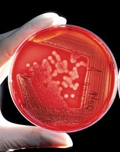 Hemácias em uma placa de Petri são utilizadas para o diagnóstico de infecção por estafilococos. Foto: Divulgação / Wikipédia
